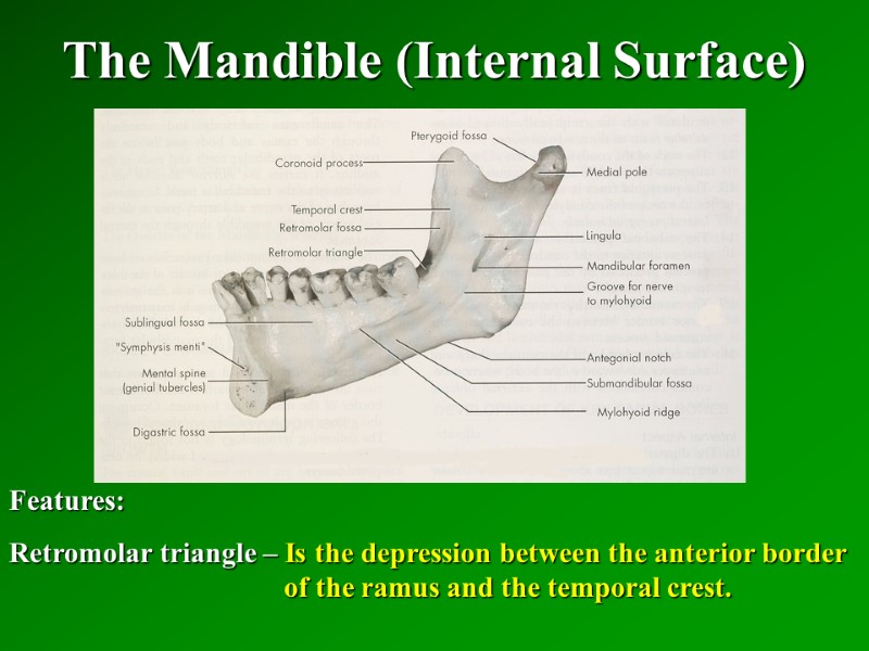 The Mandible (Internal Surface)   Features: Retromolar triangle – Is the depression between